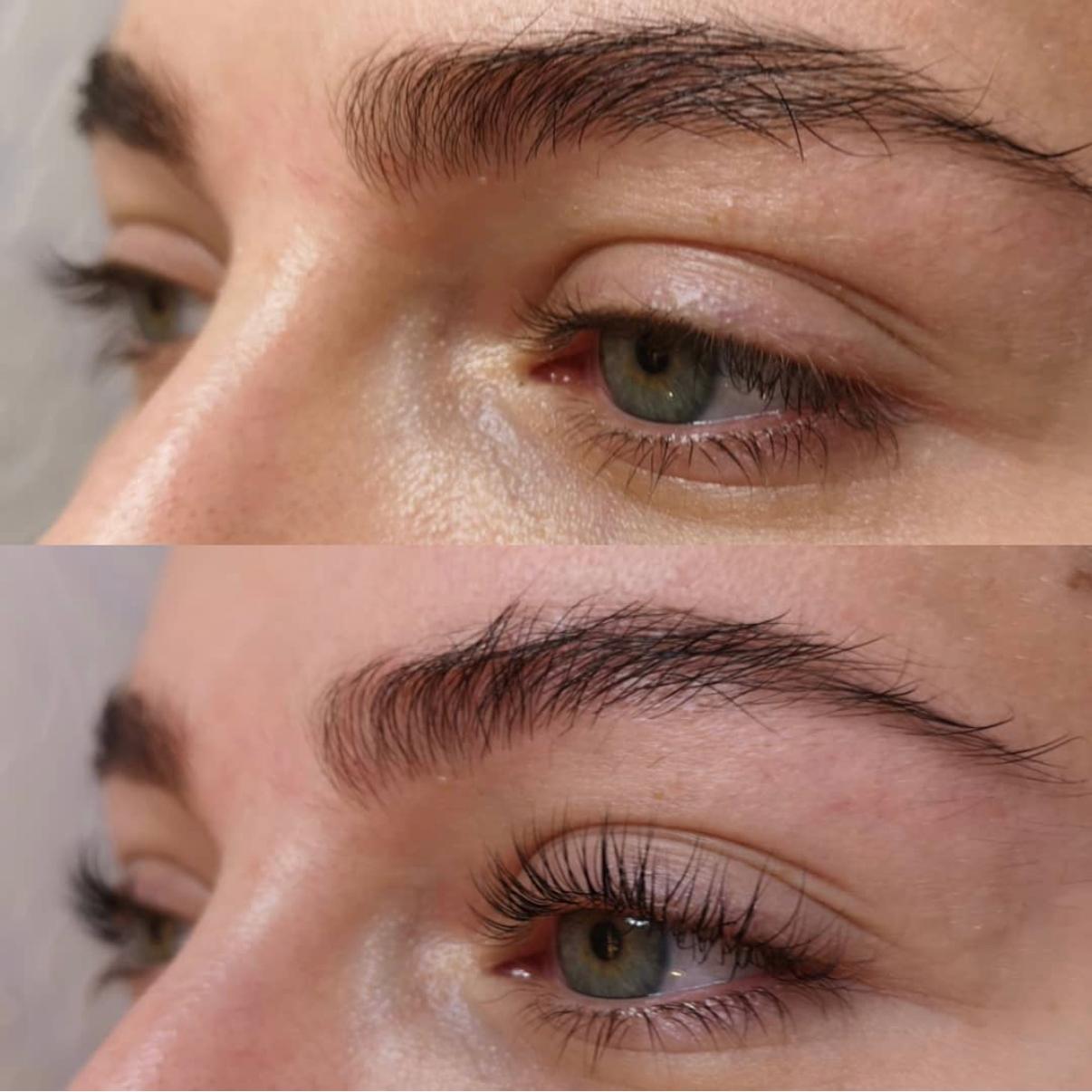 Wimpernlifting
